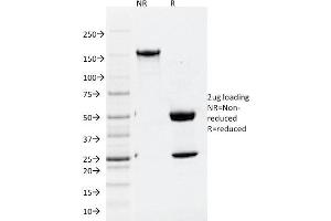 SDS-PAGE (SDS) image for anti-ATG5 Autophagy Related 5 (ATG5) (AA 1-119) antibody (ABIN6941155)