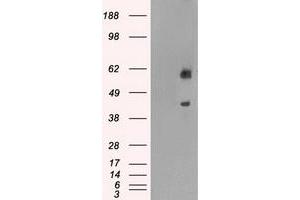 HEK293T cells were transfected with the pCMV6-ENTRY control (Left lane) or pCMV6-ENTRY PPP1R7 (Right lane) cDNA for 48 hrs and lysed. (PPP1R7 Antikörper)