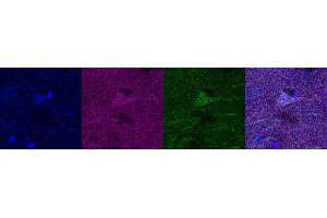 Immunohistochemistry (IHC) image for anti-Ubiquitin Carboxyl-terminal Esterase L1 (Ubiquitin Thiolesterase) (UCHL1) antibody (ABIN7456137) (UCHL1 Antikörper)