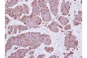 Image no. 1 for anti-Pleckstrin Homology Domain Containing, Family F (With FYVE Domain) Member 2 (PLEKHF2) (AA 60-249) antibody (ABIN1500276) (PLEKHF2 Antikörper  (AA 60-249))