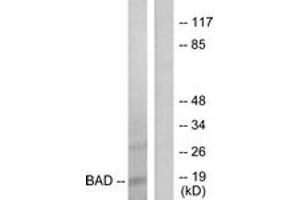 Western blot analysis of extracts from 293 cells, treated with Forskolin, using BAD (Ab-136) Antibody. (BAD Antikörper  (AA 102-151))