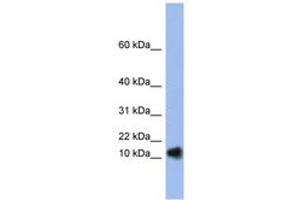 Image no. 1 for anti-Ribonuclease, RNase A Family, 1 (Pancreatic) (RNASE1) (N-Term) antibody (ABIN6742978) (RNASE1 Antikörper  (N-Term))