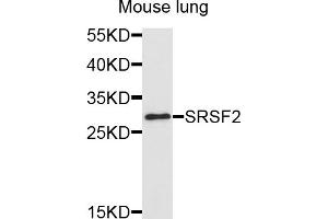 Western blot analysis of extracts of mouse lung, using SRSF2 antibody (ABIN5995581) at 1/1000 dilution. (SRSF2 Antikörper)