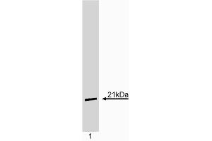 Western blot analysis of p21. (p21 Antikörper)