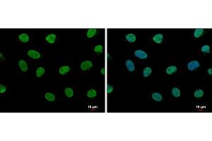 Immunofluorescence (IF) image for anti-LIM Domain Binding 1 (LDB1) antibody (ABIN2855846)