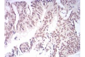 Immunohistochemistry (IHC) image for anti-Lysine (K)-Specific Demethylase 1B (KDM1B) (AA 6-129) antibody (ABIN5542688)