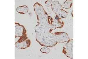 Immunohistochemistry of paraffin-embedded human placenta using S antibody (ABIN6132970, ABIN6147387, ABIN6147388 and ABIN6215904) at dilution of 1:100 (40x lens). (SARS2 Antikörper  (AA 289-518))