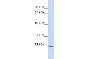 WB Suggested Anti-ZFAND5 Antibody Titration:  0. (ZFAND5 Antikörper  (Middle Region))