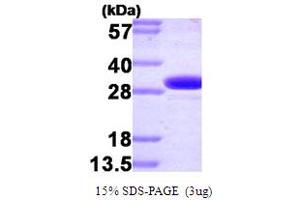 SDS-PAGE (SDS) image for Carbonic Anhydrase II (CA2) (AA 1-260) protein (ABIN667740) (CA2 Protein (AA 1-260))