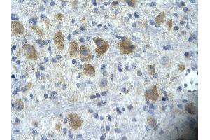 Rabbit Anti-TAF15 Antibody       Paraffin Embedded Tissue:  Human neural cell   Cellular Data:  Epithelial cells of renal tubule  Antibody Concentration:   4. (TAF15 Antikörper  (N-Term))