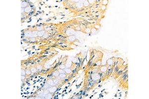 Immunohistochemistry of paraffin embedded human colon using ATP1HC1 (ABIN7073160) at dilution of 1:500 (400x lens) (ATP12A Antikörper)