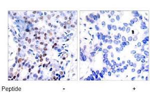 Image no. 2 for anti-Jun Proto-Oncogene (JUN) (AA 89-93) antibody (ABIN197128) (C-JUN Antikörper  (AA 89-93))
