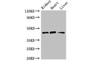 Western Blot Positive WB detected in: Mouse kidney tissue, Rat heart tissue, Rat liver tissue All lanes: WTAP antibody at 3 μg/mL Secondary Goat polyclonal to rabbit IgG at 1/50000 dilution Predicted band size: 45, 18 kDa Observed band size: 45 kDa (WTAP Antikörper  (AA 1-151))