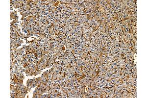 ABIN7095879 and ABIN7099941 at 1/100 staining mouse liver tissue by IHC-P. (DHX30 Antikörper)