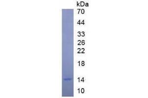 Image no. 2 for Insulin-Like Growth Factor 1 (IGF1) (AA 49-118) (Active) protein (His tag) (ABIN6239739)