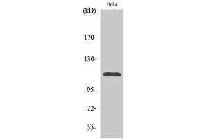 Western Blotting (WB) image for anti-Signal Transducer and Activator of Transcription 2, 113kDa (STAT2) (pTyr690) antibody (ABIN5957653) (STAT2 Antikörper  (pTyr690))