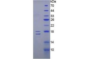 SDS-PAGE analysis of Human Inhibin beta E Protein. (INHBE Protein)