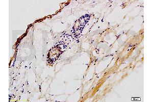 Formalin-fixed and paraffin embedded rat skin tissue labeled with Anti-CK2 Polyclonal Antibody,Unconjugated (ABIN730813) at 1:200 followed by conjugation to the secondary antibody and DAB staining