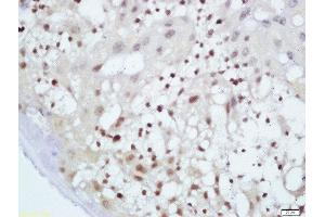 Formalin-fixed and paraffin embedded mouse placenta labeled with Anti-GnRHR Polyclonal Antibody, Unconjugated  at 1:200 followed by conjugation to the secondary antibody and DAB staining (MAF Antikörper  (AA 341-403))