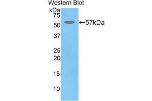 Western Blotting (WB) image for anti-Glucosidase, Beta, Acid (GBA) (AA 248-508) antibody (ABIN3205107) (GBA Antikörper  (AA 248-508))