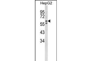 Western blot analysis of HEXA Antibody (Center) (ABIN652263 and ABIN2841133) in HepG2 cell line lysates (35 μg/lane). (Hexosaminidase A Antikörper  (AA 315-343))