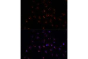 Immunofluorescence analysis of C6 cells using METTL16 antibody (ABIN7268501) at dilution of 1:100. (METTL16 Antikörper  (AA 263-562))