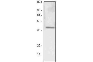A549 (lung carcinoma) cell lysate was resolved by SDS-PAGE, transferred to PVDF membrane and probed with anti-human LYVE-1 antibody (1:500). (LYVE1 Antikörper  (AA 25-235))