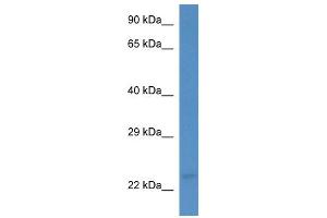 Western Blotting (WB) image for anti-Membrane-Associated Ring Finger (C3HC4) 3, E3 Ubiquitin Protein Ligase (MARCH3) (C-Term) antibody (ABIN2781280)