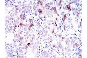 Immunohistochemistry (IHC) image for anti-Solute Carrier Family 27 (Fatty Acid Transporter), Member 5 (SLC27A5) (AA 508-570) antibody (ABIN1845743) (SLC27A5 Antikörper  (AA 508-570))