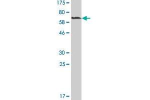 Western Blot detection against Immunogen (60. (MAGEA11 Antikörper  (AA 1-319))