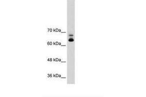Image no. 2 for anti-Metastasis Associated 1 Family, Member 2 (MTA2) (C-Term) antibody (ABIN203470)