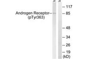 Western blot analysis of extracts from Jurkat cells treated with UV 15', using Androgen Receptor (Phospho-Tyr363) Antibody. (Androgen Receptor Antikörper  (pTyr363))