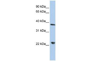 DDX25 antibody used at 1 ug/ml to detect target protein. (DDX25 Antikörper)