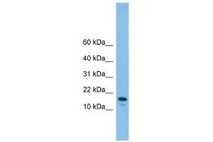GREM2 antibody used at 1 ug/ml to detect target protein. (GREM2 Antikörper)