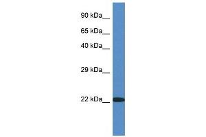 Western Blot showing RPL14 antibody used at a concentration of 1 ug/ml against Fetal Kidney Lysate (RPL14 Antikörper  (C-Term))