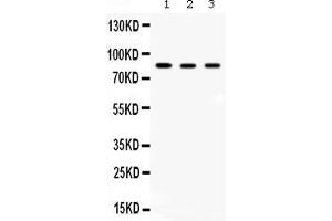 Western blot analysis of Aconitase 2 expression in rat skeletal muscle extract ( Lane 1), mouse brain extract ( Lane 2) and HELA whole cell lysates ( Lane 3). (ACO2 Antikörper  (C-Term))