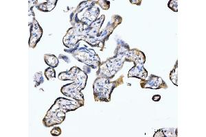 IHC analysis of PDE4DIP using anti-PDE4DIP antibody (ABIN7602691). (PDE4DIP Antikörper  (AA 96-1254))
