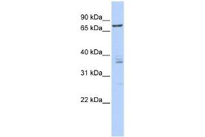 CSTF3 antibody used at 1 ug/ml to detect target protein. (CSTF3 Antikörper  (Middle Region))