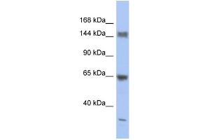 WB Suggested Anti-ATXN2 Antibody Titration:  0. (Ataxin 2 Antikörper  (Middle Region))
