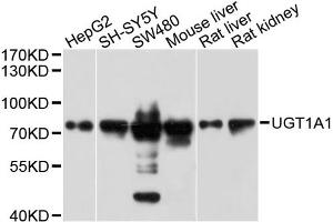 Western blot analysis of extracts of various cell lines, using μgT1A1 antibody (ABIN5999142) at 1/1000 dilution. (UGT1A1 Antikörper)