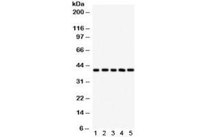 Western blot testing of 1) human HeLa, 2) human A549, 3) human U87, 4) rat brain and 5) rat liver lysate with HLA-C antibody.