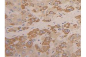 IHC-P analysis of Human Liver Tissue, with DAB staining. (INHBC Antikörper  (AA 236-352))