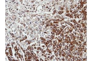 IHC-P Image Immunohistochemical analysis of paraffin-embedded MDA-MB-468 xenograft, using FPGT, antibody at 1:100 dilution. (FPGT Antikörper)