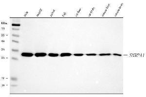 Western blot analysis of SNRPA1 using anti-SNRPA1 antibody (ABIN7599131). (SNRPA1 Antikörper  (AA 1-233))