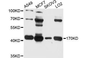 Western blot analysis of extract of various cells, using BDH1 antibody. (BDH1 Antikörper)
