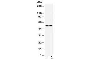 Western blot testing of human 1) HeLa and 2) Jurkat lysate wtih SLC2A1 antibody. (GLUT1 Antikörper  (AA 92-492))