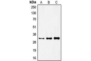 Western blot analysis of FOXR1 expression in HeLa (A), mouse kidney (B), rat kidney (C) whole cell lysates. (FOXR1 Antikörper  (C-Term))