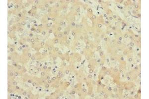 Immunohistochemistry of paraffin-embedded human liver tissue using ABIN7174246 at dilution of 1:100 (COQ4 Antikörper  (AA 31-265))