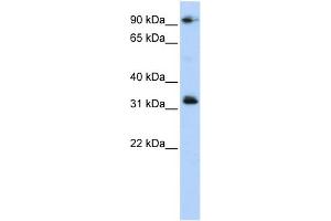 WB Suggested Anti-CCDC69 Antibody Titration: 0. (CCDC69 Antikörper  (Middle Region))
