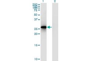 Western Blot analysis of RPP30 expression in transfected 293T cell line by RPP30 polyclonal antibody (A01). (RPP30 Antikörper  (AA 169-268))